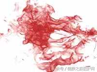 痔瘡會發(fā)展成直腸癌嗎？出現(xiàn)這5種癥狀，小心“菊部”有癌！