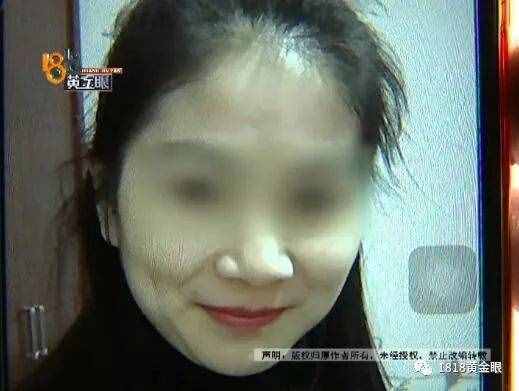 女子去點(diǎn)痣，一顆痣80元，點(diǎn)了110顆！老公怒了，結(jié)果……