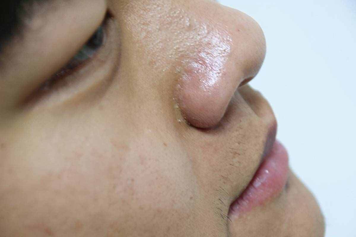 成年人睡覺(jué)總流口水，是什么原因？身體給出的信號(hào)，希望能讀懂