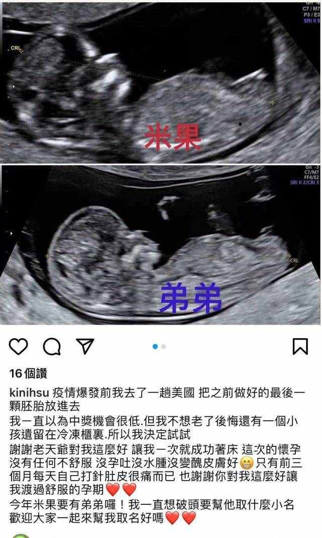 羅志祥43歲經(jīng)紀人小霜宣布懷二胎，仍是試管嬰兒，孩子父親不詳
