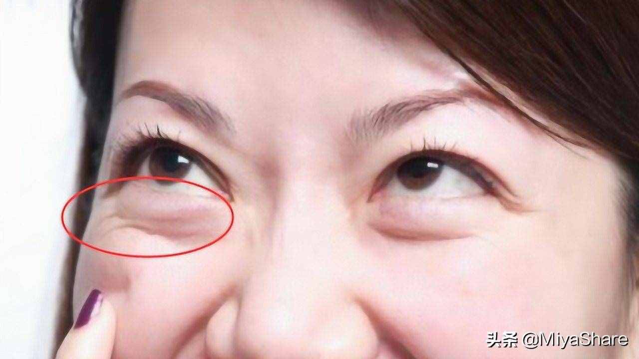 醒醒吧：什么眼霜都救不了黑眼圈！6款眼霜分析：這2款又貴又沒用