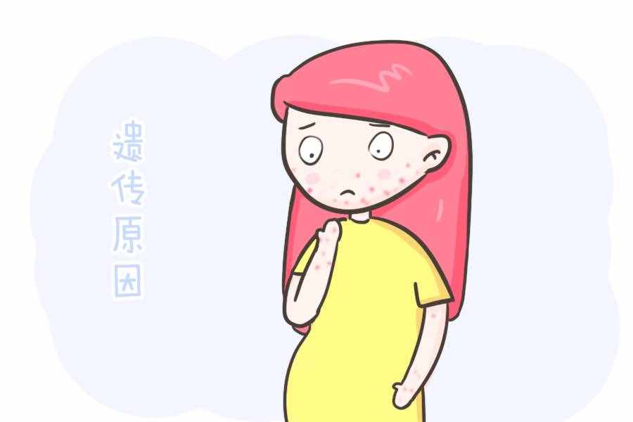 寶寶易患濕疹，其實都是因為這些原因在作祟，有需要的快收藏吧