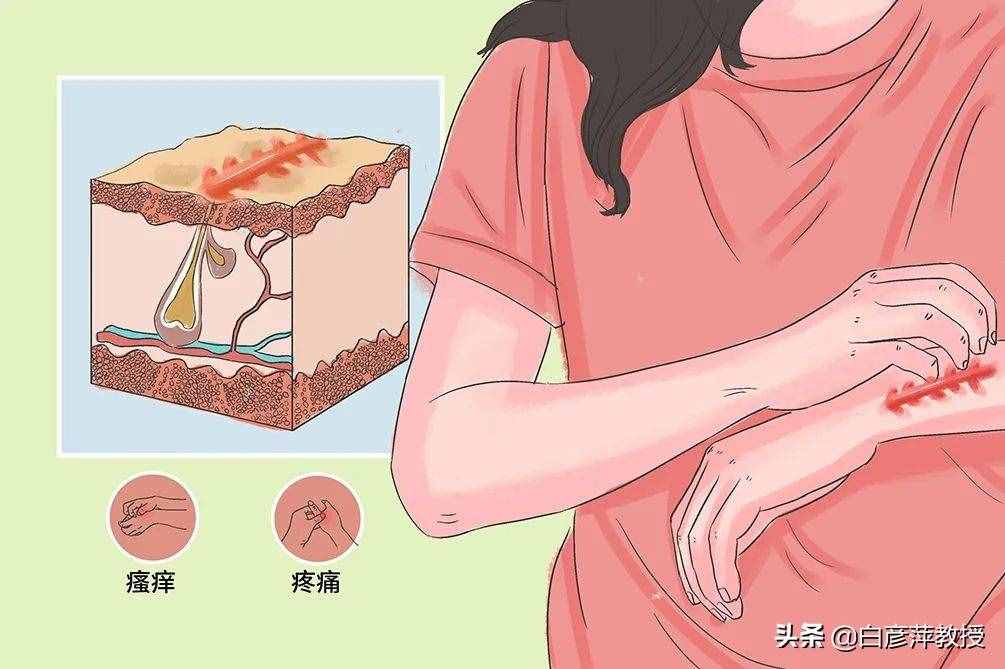 常見的皮膚病有哪些？該如何分類？日常如何預防？