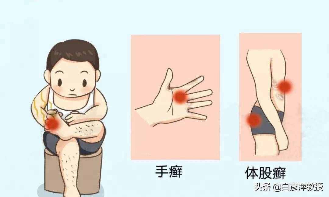 常見的皮膚病有哪些？該如何分類？日常如何預防？