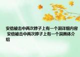 安倍被擊中兩次脖子上有一個(gè)洞詳細(xì)內(nèi)容 安倍被擊中兩次脖子上有一個(gè)洞具體介紹