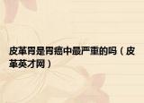 皮革胃是胃癌中最嚴(yán)重的嗎（皮革英才網(wǎng)）