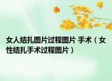 女人結(jié)扎圖片過程圖片 手術(shù)（女性結(jié)扎手術(shù)過程圖片）