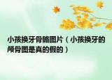 小孩換牙骨骼圖片（小孩換牙的顱骨圖是真的假的）