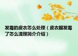 發(fā)霉的皮衣怎么處理（皮衣服發(fā)霉了怎么清理簡(jiǎn)介介紹）