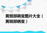 黃斑部病變圖片大全（黃斑部病變）