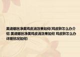 美迪娜絲凈美雞皮消效果如何(雞皮膚怎么辦介紹 美迪娜絲凈美雞皮消效果如何 雞皮膚怎么辦詳細(xì)情況如何)