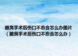 腋臭手術(shù)后傷口不愈合怎么辦圖片（腋臭手術(shù)后傷口不愈合怎么辦）