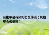 灰指甲會(huì)傳染嗎怎么傳染（灰指甲會(huì)傳染嗎）