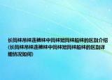長筒襪吊襪連褲襪中筒襪短筒襪船襪的區(qū)別介紹(長筒襪吊襪連褲襪中筒襪短筒襪船襪的區(qū)別詳細情況如何)