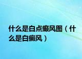 什么是白點癲風(fēng)圖（什么是白癜風(fēng)）