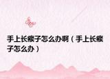 手上長瘊子怎么辦啊（手上長瘊子怎么辦）