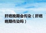 肝癌晚期會(huì)傳染（肝癌晚期傳染嗎）