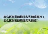 怎么區(qū)別乳腺增生和乳腺癌圖片（怎么區(qū)別乳腺增生和乳腺癌）