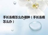 手長凍瘡怎么辦很腫（手長凍瘡怎么辦）