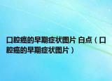 口腔癌的早期癥狀圖片 白點（口腔癌的早期癥狀圖片）