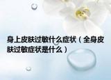 身上皮膚過敏什么癥狀（全身皮膚過敏癥狀是什么）