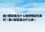 腦ct都能查出什么病頸椎能檢查嗎（腦ct都能查出什么?。? /></span></a>
                        <h2><a href=