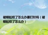 被蜈蚣咬了怎么辦要打針嗎（被蜈蚣咬了怎么辦）