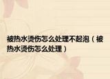 被熱水燙傷怎么處理不起泡（被熱水燙傷怎么處理）