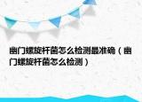 幽門螺旋桿菌怎么檢測最準(zhǔn)確（幽門螺旋桿菌怎么檢測）