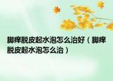 腳癢脫皮起水泡怎么治好（腳癢脫皮起水泡怎么治）