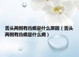 舌頭兩側有齒痕是什么原因（舌頭兩側有齒痕是什么?。? /></span></a>
                        <h2><a href=