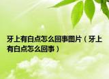 牙上有白點(diǎn)怎么回事圖片（牙上有白點(diǎn)怎么回事）