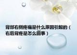 背部右側(cè)疼痛是什么原因引起的（右后背疼是怎么回事）