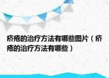 疥瘡的治療方法有哪些圖片（疥瘡的治療方法有哪些）