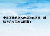 小孩子肚臍上方疼是怎么回事（肚臍上方疼是怎么回事）