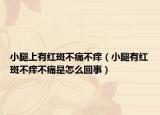 小腿上有紅斑不痛不癢（小腿有紅斑不癢不痛是怎么回事）