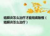 結(jié)膜炎怎么治療才能徹底除根（結(jié)膜炎怎么治療）