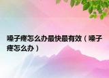 嗓子疼怎么辦最快最有效（嗓子疼怎么辦）