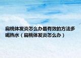扁桃體發(fā)炎怎么辦最有效的方法多喝熱水（扁桃體發(fā)炎怎么辦）