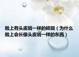 臉上有頭皮屑一樣的碎屑（為什么臉上會長像頭皮屑一樣的東西）