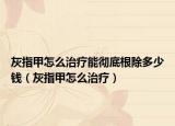 灰指甲怎么治療能徹底根除多少錢（灰指甲怎么治療）