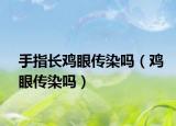 手指長(zhǎng)雞眼傳染嗎（雞眼傳染嗎）