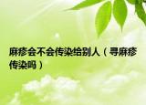 麻疹會不會傳染給別人（尋麻疹傳染嗎）