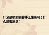 什么是銀屑病的特征性表現(xiàn)（什么是銀屑?。? /></span></a>
                        <h2><a href=