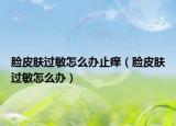 臉皮膚過敏怎么辦止癢（臉皮膚過敏怎么辦）