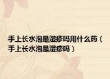 手上長水泡是濕疹嗎用什么藥（手上長水泡是濕疹嗎）