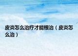 皮炎怎么治療才能根治（皮炎怎么治）