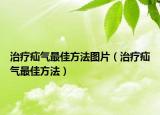 治療疝氣最佳方法圖片（治療疝氣最佳方法）