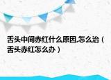 舌頭中間赤紅什么原因,怎么治（舌頭赤紅怎么辦）