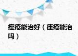 痤瘡能治好（痤瘡能治嗎）